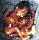 abortion abortion index, abortion directory, pregnancy, clinic, abortionist, pregnancy,  fetus, pro-life, prolife, pro-choice, prochoice, feminist, woman, women, embryo, Christian, population control,  abortion survivors, reports, essays, school, violence, college, doctors,  sex, sexual, STD's, birth-control, abstience, adoption, adopt, parent, mother, father, education,  abortion opinions, abortion articles,  human life,  abortiontv,  AIDS,  abortion procedures, abortion history, abortion politics,  abortion appointmentabortion prochoice abortion abortion abortion aborted abortion prochoiceprochoice abortion abortion abortion aborted abortion prochoice