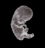 prochoice, pro-choice, abortion, abortionist, women, woman, fetal, pregnancy, prolife, pro-life, anti-abortion, fetus, embryo, anti-life, clinic, doctor, pregnant, debate, feminist, information