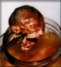 abortion prochoice