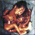 abortion prochoice