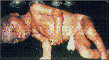 abortion prochoice