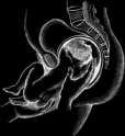 prochoice, pro-choice, abortion, abortionist, women, woman, fetal, pregnancy, prolife, pro-life, anti-abortion, fetus, embryo, anti-life, clinic, doctor, pregnant, debate, feminist, information