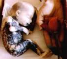 abortion abortion index, abortion directory, pregnancy, clinic, abortionist, pregnancy,  fetus, pro-life, prolife, pro-choice, prochoice, feminist, woman, women, embryo, Christian, population control,  abortion survivors, reports, essays, school, violence, college, doctors,  sex, sexual, STD's, birth-control, abstience, adoption, adopt, parent, mother, father, education,  abortion opinions, abortion articles,  human life,  abortiontv,  AIDS,  abortion procedures, abortion history, abortion politics,  abortion appointmentabortion prochoice abortion abortion abortion aborted abortion prochoice prochoice abortion abortion abortion aborted abortion prochoice