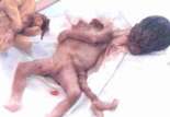 abortion abortion index, abortion directory, pregnancy, clinic, abortionist, pregnancy,  fetus, pro-life, prolife, pro-choice, prochoice, feminist, woman, women, embryo, Christian, population control,  abortion survivors, reports, essays, school, violence, college, doctors,  sex, sexual, STD's, birth-control, abstience, adoption, adopt, parent, mother, father, education,  abortion opinions, abortion articles,  human life,  abortiontv,  AIDS,  abortion procedures, abortion history, abortion politics,  abortion appointmentabortion prochoice abortion abortion abortion aborted abortion prochoice prochoice abortion abortion abortion aborted abortion prochoice