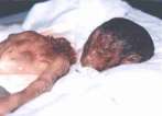 abortion abortion index, abortion directory, pregnancy, clinic, abortionist, pregnancy,  fetus, pro-life, prolife, pro-choice, prochoice, feminist, woman, women, embryo, Christian, population control,  abortion survivors, reports, essays, school, violence, college, doctors,  sex, sexual, STD's, birth-control, abstience, adoption, adopt, parent, mother, father, education,  abortion opinions, abortion articles,  human life,  abortiontv,  AIDS,  abortion procedures, abortion history, abortion politics,  abortion appointmentabortion prochoice abortion abortion abortion aborted abortion prochoice prochoice abortion abortion abortion aborted abortion prochoice