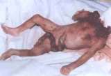 abortion abortion index, abortion directory, pregnancy, clinic, abortionist, pregnancy,  fetus, pro-life, prolife, pro-choice, prochoice, feminist, woman, women, embryo, Christian, population control,  abortion survivors, reports, essays, school, violence, college, doctors,  sex, sexual, STD's, birth-control, abstience, adoption, adopt, parent, mother, father, education,  abortion opinions, abortion articles,  human life,  abortiontv,  AIDS,  abortion procedures, abortion history, abortion politics,  abortion appointmentabortion prochoice abortion abortion abortion aborted abortion prochoice prochoice abortion abortion abortion aborted abortion prochoice