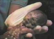 abortion abortion index, abortion directory, pregnancy, clinic, abortionist, pregnancy,  fetus, pro-life, prolife, pro-choice, prochoice, feminist, woman, women, embryo, Christian, population control,  abortion survivors, reports, essays, school, violence, college, doctors,  sex, sexual, STD's, birth-control, abstience, adoption, adopt, parent, mother, father, education,  abortion opinions, abortion articles,  human life,  abortiontv,  AIDS,  abortion procedures, abortion history, abortion politics,  abortion appointmentabortion prochoice abortion abortion abortion aborted abortion prochoiceprochoice abortion abortion abortion aborted abortion prochoice