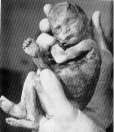 abortion abortion index, abortion directory, pregnancy, clinic, abortionist, pregnancy,  fetus, pro-life, prolife, pro-choice, prochoice, feminist, woman, women, embryo, Christian, population control,  abortion survivors, reports, essays, school, violence, college, doctors,  sex, sexual, STD's, birth-control, abstience, adoption, adopt, parent, mother, father, education,  abortion opinions, abortion articles,  human life,  abortiontv,  AIDS,  abortion procedures, abortion history, abortion politics,  abortion appointmentabortion prochoice abortion abortion abortion aborted abortion prochoice prochoice abortion abortion abortion aborted abortion prochoice