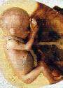 abortion abortion index, abortion directory, pregnancy, clinic, abortionist, pregnancy,  fetus, pro-life, prolife, pro-choice, prochoice, feminist, woman, women, embryo, Christian, population control,  abortion survivors, reports, essays, school, violence, college, doctors,  sex, sexual, STD's, birth-control, abstience, adoption, adopt, parent, mother, father, education,  abortion opinions, abortion articles,  human life,  abortiontv,  AIDS,  abortion procedures, abortion history, abortion politics,  abortion appointmentabortion prochoice abortion abortion abortion aborted abortion prochoice prochoice abortion abortion abortion aborted abortion prochoice