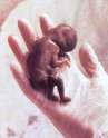 abortion prochoice abortion index, abortion directory, pregnancy, clinic, abortionist, pregnancy,  fetus, pro-life, prolife, pro-choice, prochoice, feminist, woman, women, embryo, Christian, population control,  abortion survivors, reports, essays, school, violence, college, doctors,  sex, sexual, STD's, birth-control, abstience, adoption, adopt, parent, mother, father, education,  abortion opinions, abortion articles,  human life,  abortiontv,  AIDS,  abortion procedures, abortion history, abortion politics,  abortion appointmentabortion prochoice abortion abortion abortion aborted abortion prochoice abortion abortion abortion aborted abortion prochoice
