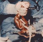 abortion abortion index, abortion directory, pregnancy, clinic, abortionist, pregnancy,  fetus, pro-life, prolife, pro-choice, prochoice, feminist, woman, women, embryo, Christian, population control,  abortion survivors, reports, essays, school, violence, college, doctors,  sex, sexual, STD's, birth-control, abstience, adoption, adopt, parent, mother, father, education,  abortion opinions, abortion articles,  human life,  abortiontv,  AIDS,  abortion procedures, abortion history, abortion politics,  abortion appointmentabortion prochoice abortion abortion abortion aborted abortion prochoiceprochoice abortion abortion abortion aborted abortion prochoice