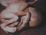 abortion abortion index, abortion directory, pregnancy, clinic, abortionist, pregnancy,  fetus, pro-life, prolife, pro-choice, prochoice, feminist, woman, women, embryo, Christian, population control,  abortion survivors, reports, essays, school, violence, college, doctors,  sex, sexual, STD's, birth-control, abstience, adoption, adopt, parent, mother, father, education,  abortion opinions, abortion articles,  human life,  abortiontv,  AIDS,  abortion procedures, abortion history, abortion politics,  abortion appointmentabortion prochoice abortion abortion abortion aborted abortion prochoice prochoice abortion abortion abortion aborted abortion prochoice