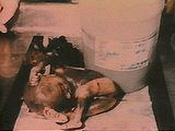 abortion abortion index, abortion directory, pregnancy, clinic, abortionist, pregnancy,  fetus, pro-life, prolife, pro-choice, prochoice, feminist, woman, women, embryo, Christian, population control,  abortion survivors, reports, essays, school, violence, college, doctors,  sex, sexual, STD's, birth-control, abstience, adoption, adopt, parent, mother, father, education,  abortion opinions, abortion articles,  human life,  abortiontv,  AIDS,  abortion procedures, abortion history, abortion politics,  abortion appointmentabortion prochoice abortion abortion abortion aborted abortion prochoice prochoice abortion abortion abortion aborted abortion prochoice