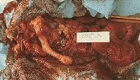 abortion abortion index, abortion directory, pregnancy, clinic, abortionist, pregnancy,  fetus, pro-life, prolife, pro-choice, prochoice, feminist, woman, women, embryo, Christian, population control,  abortion survivors, reports, essays, school, violence, college, doctors,  sex, sexual, STD's, birth-control, abstience, adoption, adopt, parent, mother, father, education,  abortion opinions, abortion articles,  human life,  abortiontv,  AIDS,  abortion procedures, abortion history, abortion politics,  abortion appointmentabortion prochoice abortion abortion abortion aborted abortion prochoiceprochoice abortion abortion abortion aborted abortion prochoice