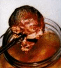abortion abortion index, abortion directory, pregnancy, clinic, abortionist, pregnancy,  fetus, pro-life, prolife, pro-choice, prochoice, feminist, woman, women, embryo, Christian, population control,  abortion survivors, reports, essays, school, violence, college, doctors,  sex, sexual, STD's, birth-control, abstience, adoption, adopt, parent, mother, father, education,  abortion opinions, abortion articles,  human life,  abortiontv,  AIDS,  abortion procedures, abortion history, abortion politics,  abortion appointmentabortion prochoice abortion abortion abortion aborted abortion prochoiceprochoice abortion abortion abortion aborted abortion prochoice