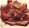 abortion abortion index, abortion directory, pregnancy, clinic, abortionist, pregnancy,  fetus, pro-life, prolife, pro-choice, prochoice, feminist, woman, women, embryo, Christian, population control,  abortion survivors, reports, essays, school, violence, college, doctors,  sex, sexual, STD's, birth-control, abstience, adoption, adopt, parent, mother, father, education,  abortion opinions, abortion articles,  human life,  abortiontv,  AIDS,  abortion procedures, abortion history, abortion politics,  abortion appointmentabortion prochoice abortion abortion abortion aborted abortion prochoice prochoice abortion abortion abortion aborted abortion prochoice