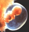 abortion prochoice
