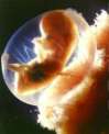 abortion prochoice