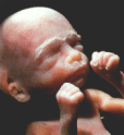 abortion prochoice